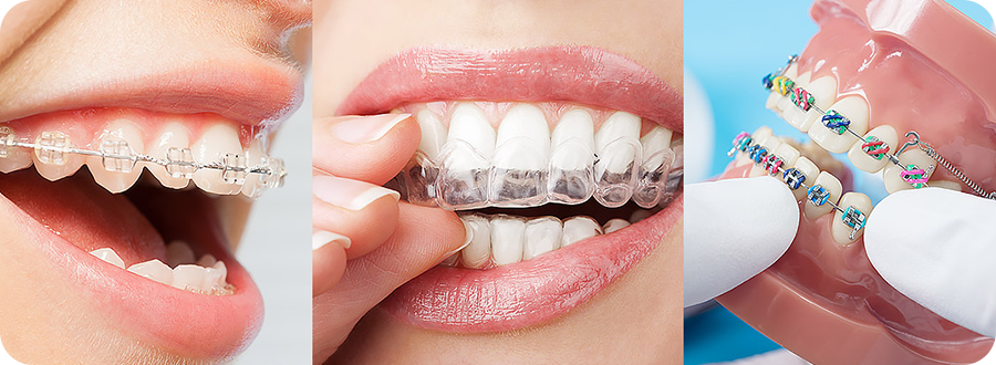 https://www.ackleydental.com/wp-content/uploads/2020/01/ackley-intro-orthodontics-v1.png