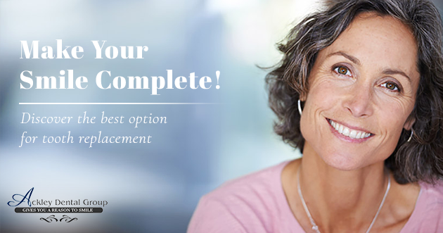 Monthlys – Ackley – Email – 630 x 331 – V1