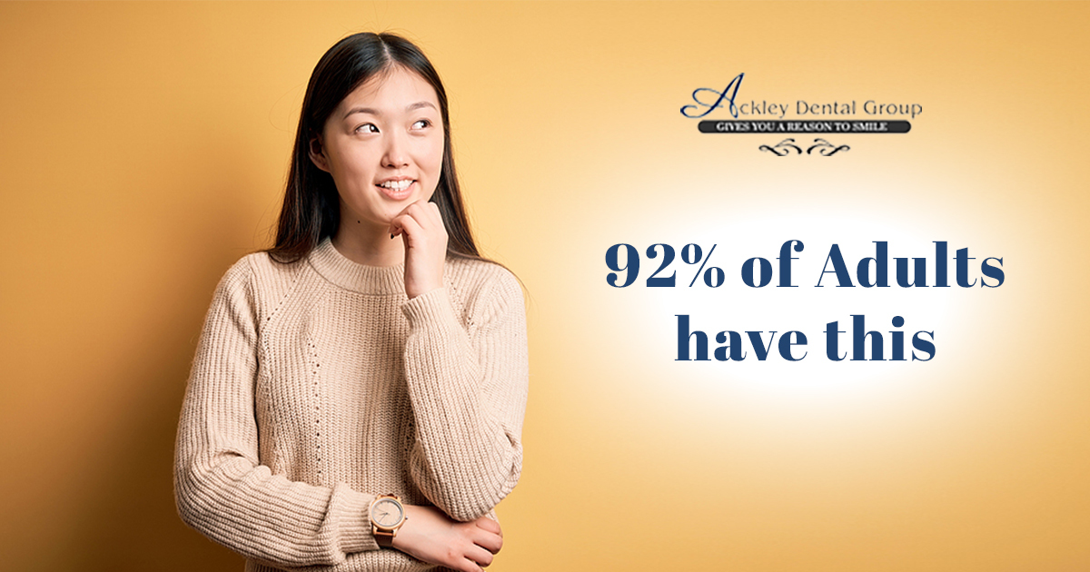 Monthlys – Ackley – Email – 1200 x 630 – V1