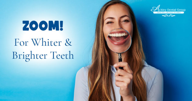 Monthlys – Ackley – October – Blog – 1200 x 630 – V1