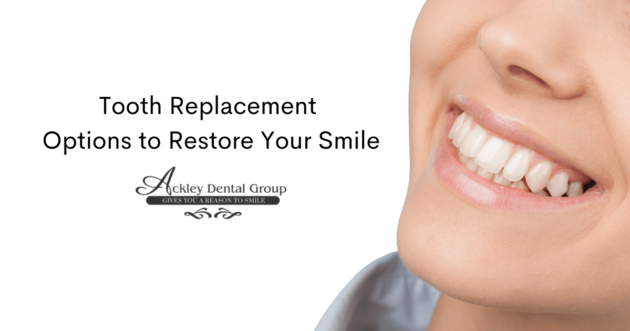 Ackley_Blog_1200x630 (1)