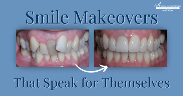 Ackley Blog Feb 2025