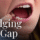 womans mouth missing a tooth